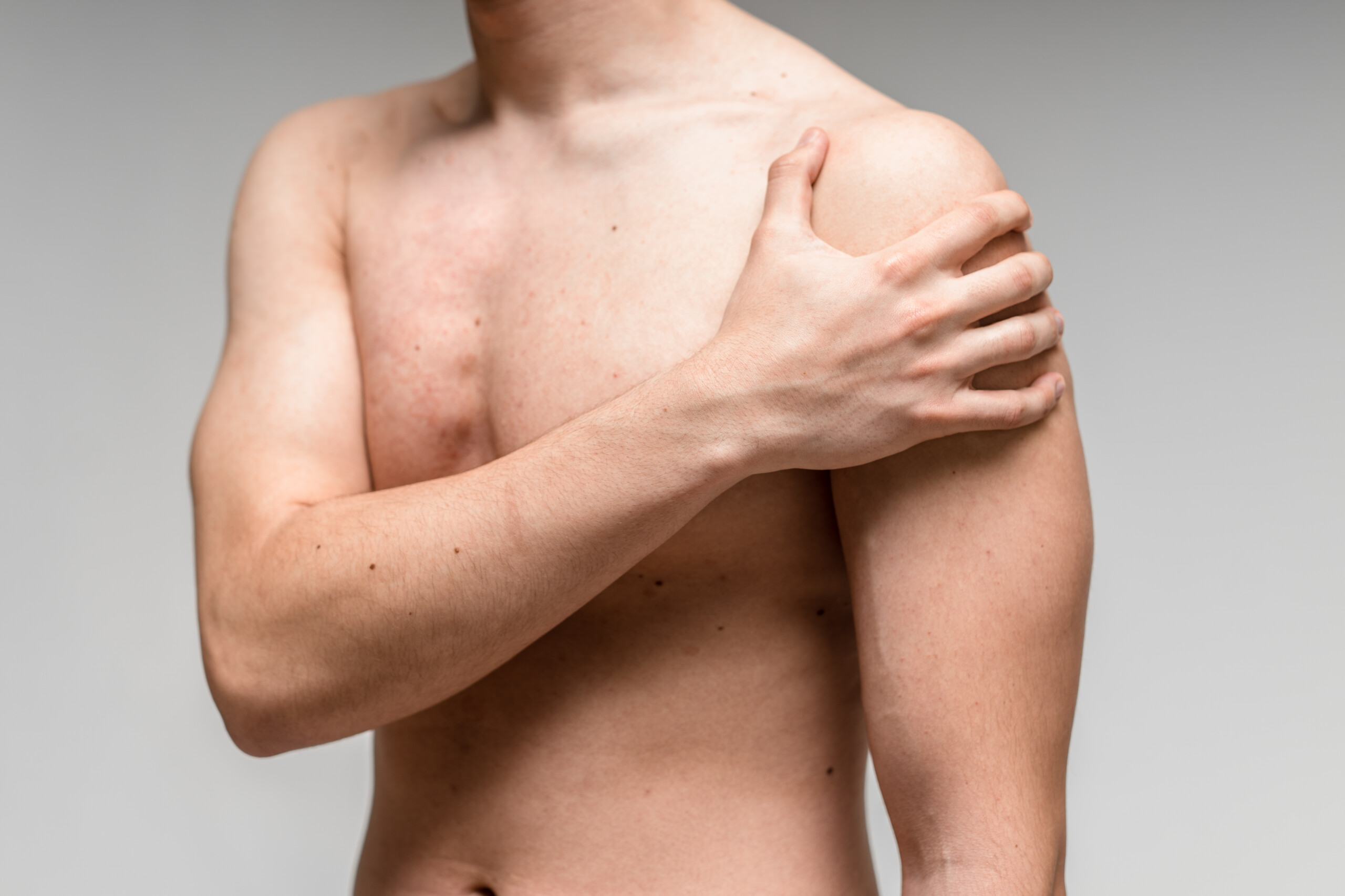 Klachten – Schouderklachten